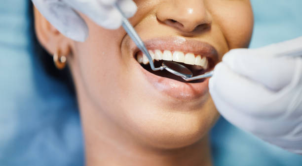 Best Emergency Dental Care for Sports Injuries in Odessa, MO